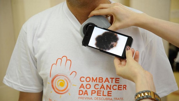 ARTIGO: Evite câncer de pele! Inverno também é época para usar protetor solar - saude, noticias