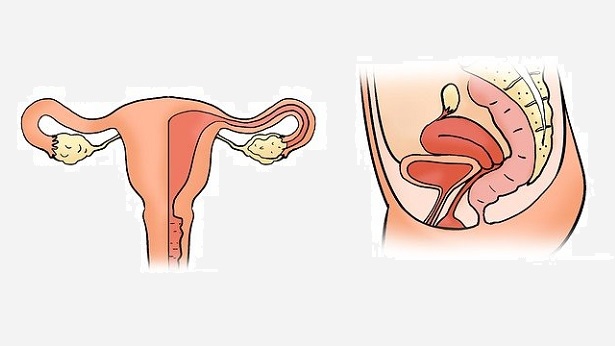 Saiba a diferença entre câncer do corpo do útero e câncer do colo do útero - saude, brasil