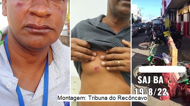 SAJ: Fiscal do município é agredido após derrubar carrinho de ambulante - saj, noticias, destaque