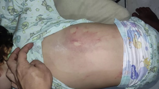 Ilhéus: Criança de 3 anos aparece em escola com marcas de espancamento - policia, ilheus, bahia