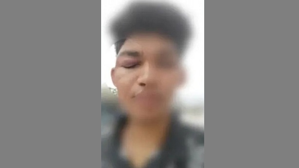 Feira de Santana: Estudante diz ter sido agredido por seguranças de universidade - feira-de-santana, educacao