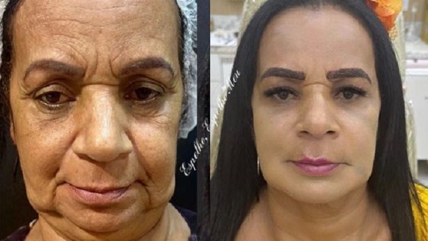 Ilhéus: Sucesso no Pânico, Solange Damasceno faz harmonização Facial - ilheus, bahia