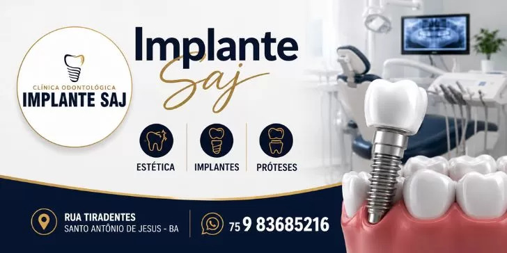 Implante SAJ - Implantes dentários em Santo Antônio de Jesus BA